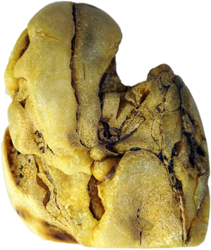 40,95 g Gintaro grynuolis (1)