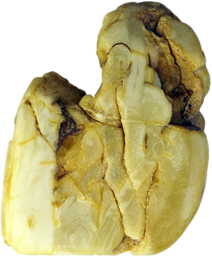 40,95 g Gintaro grynuolis (2)